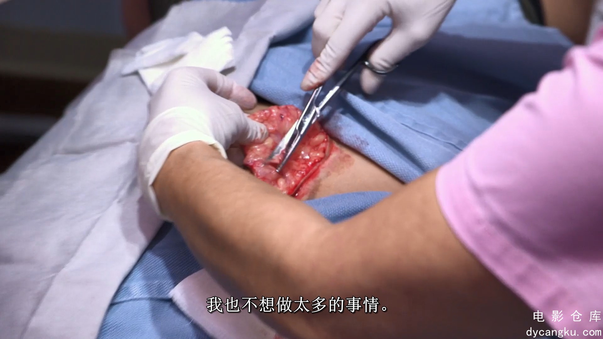 [电影仓库dycangku.com]Dr Pimple Popper_S01E06_An American Tail.mp4_snapshot_37.30.693.jpg